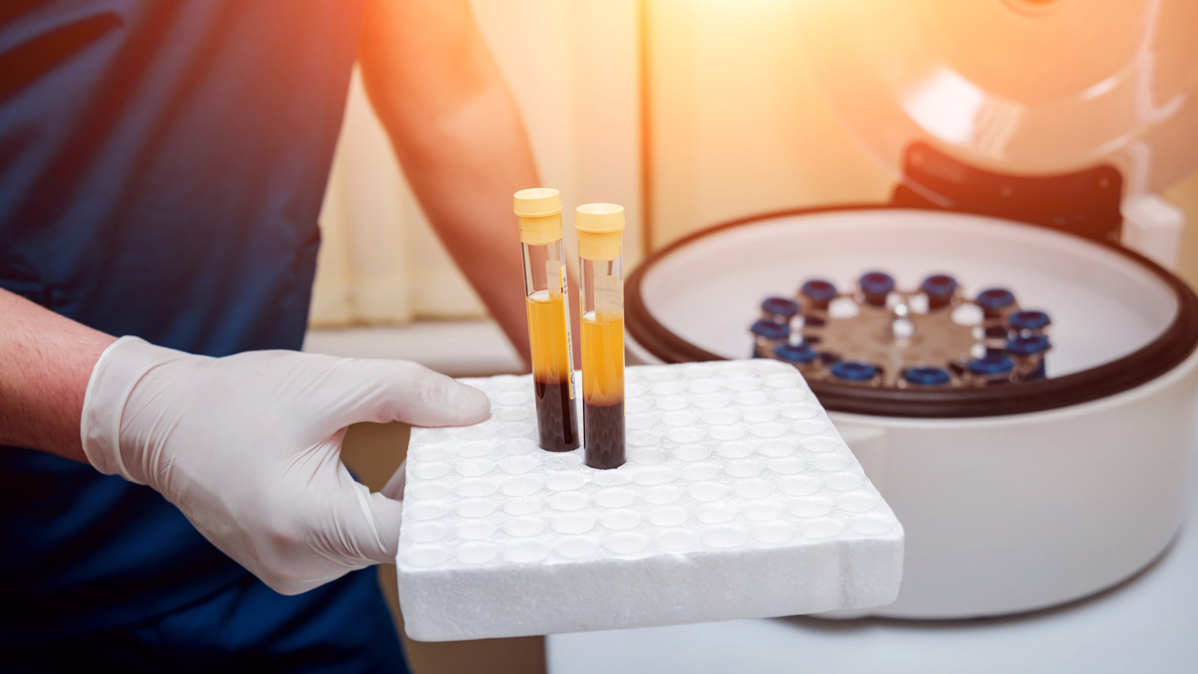 Platelet-Rich Plasma