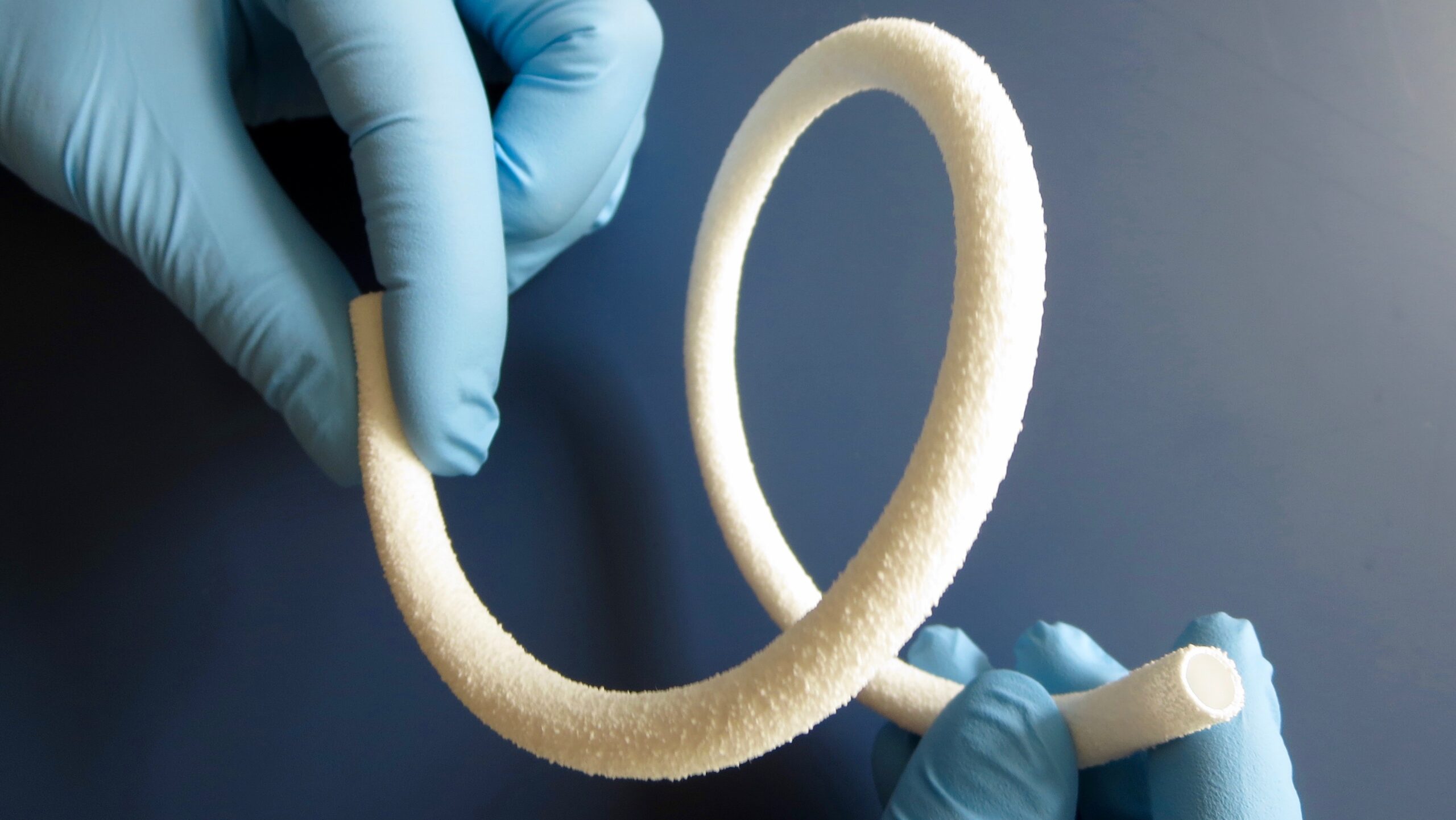 vascular graft industry